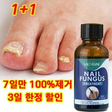 [100% 제거/국내배송] 손톱 발톱 리페어 에센스 발톱영양제 문제성발톱 앰플 발톱무좀 내성발톱, 2개, 30ml