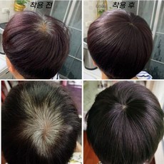 다공감 정수리 부분가발 탈모 새치 커버 100% 인모