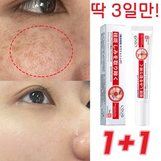 일본 1/1+1 주근깨 제거 크림 기미 잡티 검버섯 제거 미백 크림 피부 개선 20g 1+1+1(3개) 1개