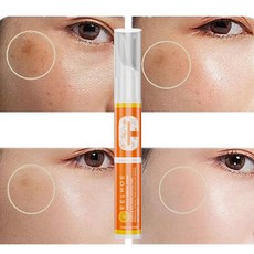 1+1 기미 잡티 크림 얼굴 색소침착 개선 흑자 제거 피부 화이트닝 에센스 톤업 미백, 15ml * 2, 2개, 15ml