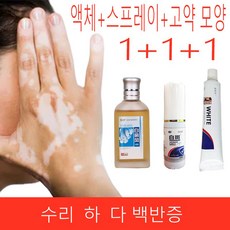 1+1+1 반점 백반증 중국 의료 흰색 반점 질병 스프레이 안료 멜라닌 피부 흰 질병 치료, 1 액체 +1 스프레이+ 1 고약 모양