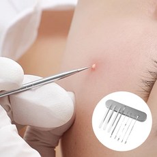 얼굴 피지 핀셋 관리 제거기 압출기
