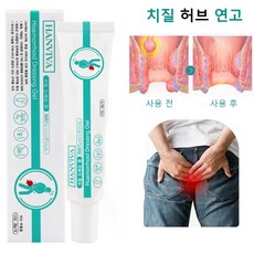 [당일배송]일본 수입 원료 치질연고 항문통증 항문출혈 항문가려움 치루 혈변 완화 연고 소양증 보습크림