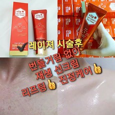 프란츠줄기세포배양액