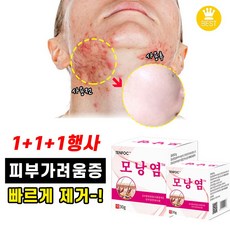 [당일배송] 1+1/1 피부 가려움증 연고 완화 지루성피부염 모낭염 여드름 크림 30g