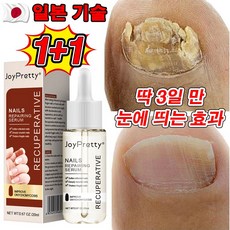 [100% 제거] 손톱 발톱 무좀 전문 영양제 문제성 무좀 100% 효과 있음 손 발톱 영양제 관리 앰플/선물 랜던 증정