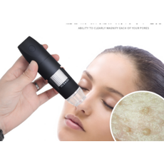 두피촬영카메라