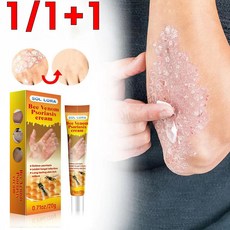  미국 1/1+1 건선 크림 습진 연고 피부염 두드러기 발진 가려움증 알레르기 20g 1+1(2개) 추친  상품 이미지