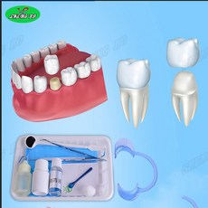 치아교정기tv선전