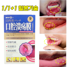 [일본기술]구내염 패치 입병약 혓바늘 구강 상처보호 입안상처 붙이는 반창고 스티커 패치