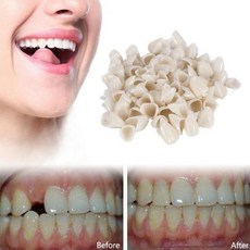 임시 전방 및 후방 어금니 캡 치과용 가짜 치아 커버 탈착식 치아 베니어, 01 Posterior Tooth, 01 CHINA, 1개