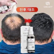 탈모 개선 효과의 탈모 영양제 두피 에센스 발모제, 1개, 100ml