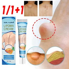 1/1+1 피지낭종 제거 연고 지방종 완화 표피낭종 제거 바디케어 크림 포장증정, 1개, 20g