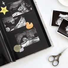 코니테일레터링초음파앨범