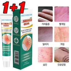 1+1 피부가려움증 연고 지루성피부염 모낭염 연고 여드름 크림