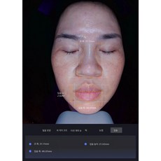 AI 피부 분석기 지능형 감지기 분석, 화이트 원더랜드 메디컬 뷰티 에디션 이비스 화이트, 1개