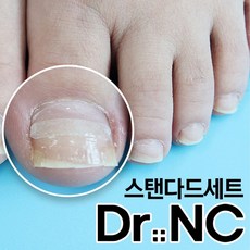 내성발톱자가치료