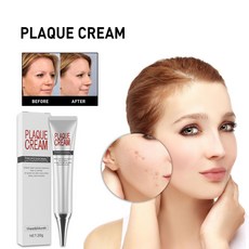플라크크림