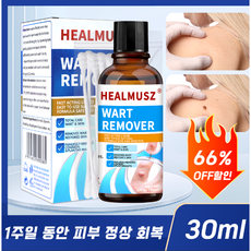 HEALMUSZ 편평 제거 피부 요철 복구 피부 관리 에센스 피부 라벨 제거, 1개, 30ml