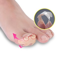 내성발톱테이프