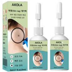 [제품 업그레이드] AKOLA 피부 깨끗해지는 제거액 피부 관리 피부 복원, 2개, 20ml