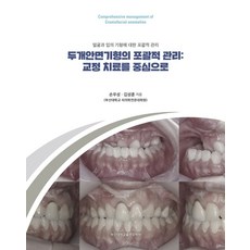 두개안면기형의 포괄적 관리: 교정 치료를 중심으로:얼굴과 입의 기형에 대한 포괄적 관리, 손우성,김성훈 공저, 부산대학교출판문화원