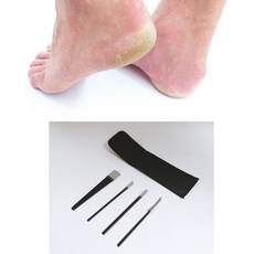 새끼발가락굳은살제거