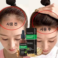 Hair Hair Grower 두피 케어 세럼 발모제, 4개, 30ml