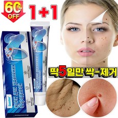 [당일출고] 1+1 얼굴 편평 피부 치료 제거 연고 손 발 치료 제거 크림 피부케어