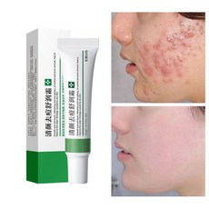 낫츠센텔라스카연고