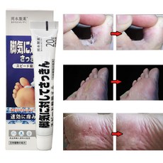 [일본 무좀약/당일발송]풋 솔루션 리페어 연고 가려움 가려움 따끔거림 발냄새 탈피 완화 가려움 방지 살균 발 탈피 억제 무좀약연고