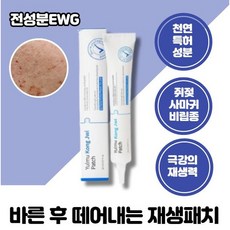 한포진