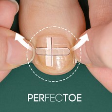 [국내 제조 특허 기술] 퍼펙토 내성발톱 교정기 스트립 자가치료 의료기기 세트, 16mm, 1개