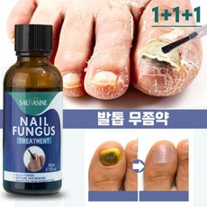 [국내출하] SAUVASINE 발톱무좀약 발톱무좀 무좀 조갑사상균증 발톱 관리 손톱 영양제 천연 성분 안전하고 자극이 없다
