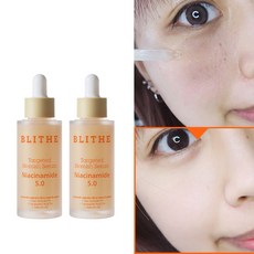 [정품][추천] HOT Blemish Serum 블라이드 타겟티드 블레미쉬 잡티감초 세럼 감초뿌리추출물 나이아신아마이드 피부진정 잡티흔적지우개 미백 여드름흔적 모공케어, 30ml, 2개 - 감초추출물