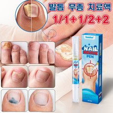 HEALMUSZ 손톱 발톱무좀 발무좀 에센스 손톱 리페어 에센스 항진균 감염 2개 30ml 상품 이미지