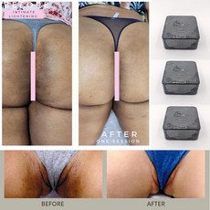 스킨 케어 아프리카 나이지리아 수제 비누 라이트닝 다크 비키니 라인 여성 100g 질 화이트닝 비누 스킨 클렌징 표백 제거 탄소비누 100g 1개 상품 이미지