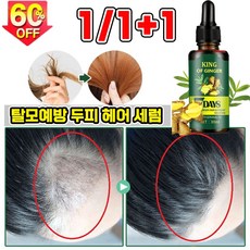[효과짱!!!] 1/1+1 탈모 모발 활력 증진 두피 모낭 보습 발모 성장 촉진에센스 탈모예방 치료 남녀공용, 5개, 30ml