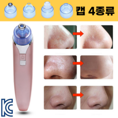 여드름 압출기 피지 제거 블랙헤드 제거기, Y02화이트