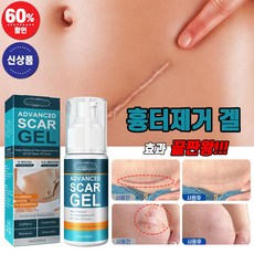 [국내배송] 흉터제거 연고 제왕절개 화상 수술 상처 피부흉터 제거겔 켈로이드 치료 리페어 크림