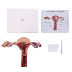 인체모형 해부학 구조 인간 여성 자궁 난소 질병 해부 병리학 모델 생물학 교육 보조 병변, 01 as Picture