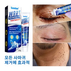 [미국 핫템] 편평사마귀 물사마귀 얼굴 물사마귀 발바닥 티눈 크림, 20g, 2개