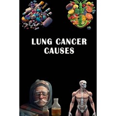 (영문도서) Lung Cancer Causes: Discover Lung Cancer Causes - Raise Awareness and Advocate for Early Dete... Paperback, Independently Published, English, 9798854412544