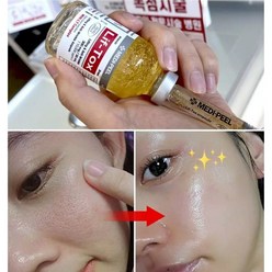 실리프팅 필러앰플 30ml/콜라겐실 리프팅실 3개국 톡스앰플/콜라겐 고톡스 안티에이징, 5%-실리프팅 앰플톡1개 원장님보톡아이 1개, 1개, 30ml