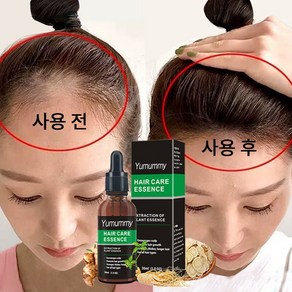 Hair Hair Grower 두피 케어 세럼 발모제