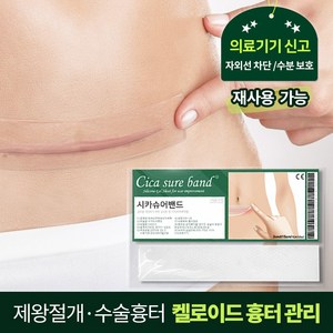 시카슈어 흉터 밴드, 1개