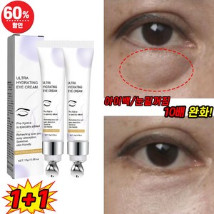 [국내배송] 1/1+1/2+2 아이팔트 아이백 크림 눈밑 지방제거 눈밑꺼짐 다크서클 아이크림 미간 주름 개선, 2개, 15g