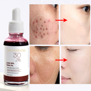 피지녹이는제품 필링 에센스 포어 클리어런스 피지관리액 블랙헤드 각질 여드름 제거, 1개, 30ml