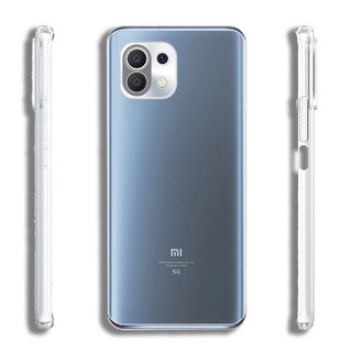 샤오미 미 11 라이트 11T 슬림핏 투명 케이스