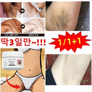 1+1 Y존 멜라닌 제거 겨드랑이 색소침착 미백 크림 멜라닌 억제팔꿈치 사타구니 미백, 50g, 1개